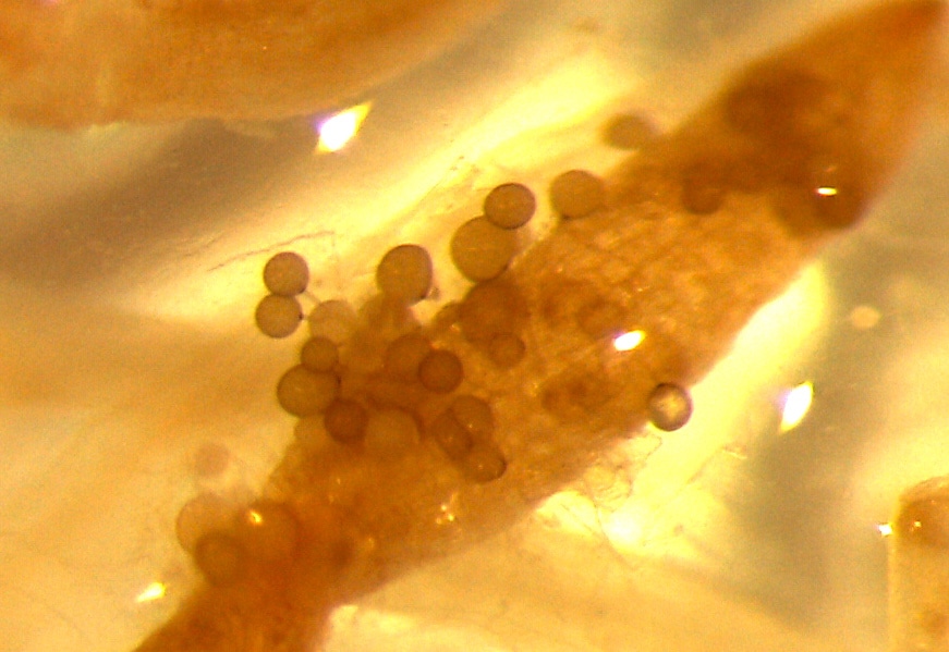 mycorrhizal fungi under microscope